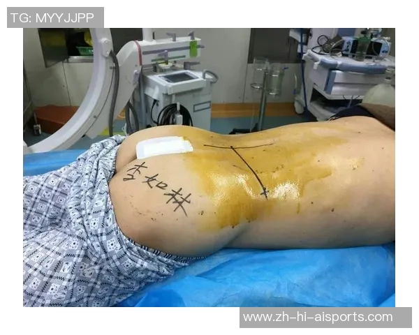 每体:亚马尔承受的耻骨微创手术并不除根,但能有用缓解痛苦